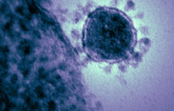 Coronavirus 2020